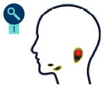 magnifying glass icon with number 1 under it next to illustration showing location of salivary glands in head