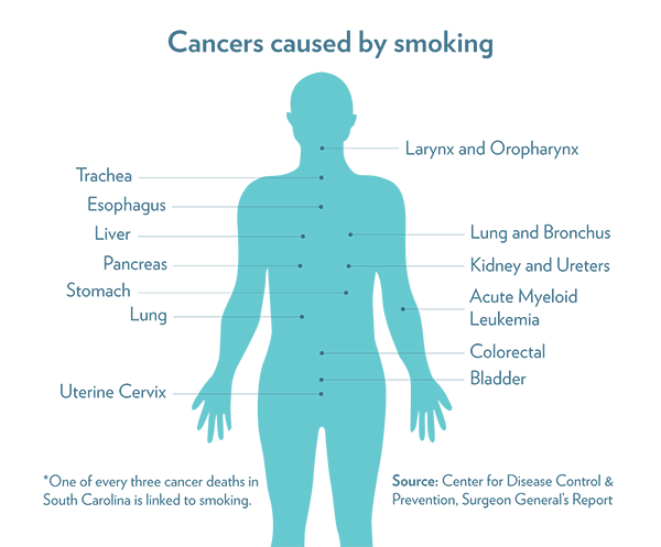 Cancers caused by smoking include oropharynx, larynx, esophagus, trachea, bronchus, lung, acute myeloid leukemia, stomach, liver, pancreas, kidney and ureters, cervix, bladder and colorectal.