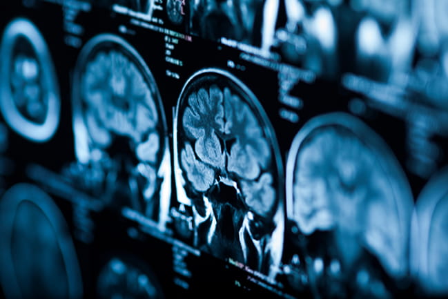 a row of brain scans on a screen