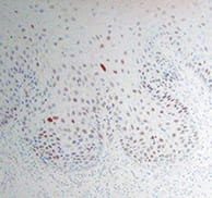 close up image showing IHC staining in human tissue