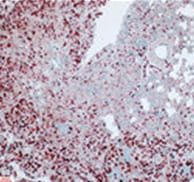 close up image showing IHC staining in mouse tissue