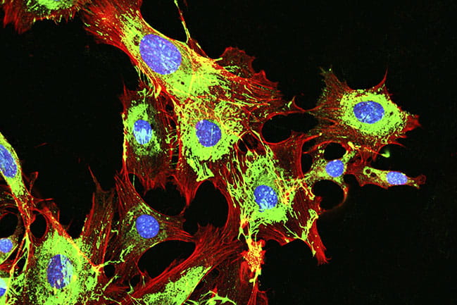 imaging of metastatic cancer cells spreading on the surrounding tissue