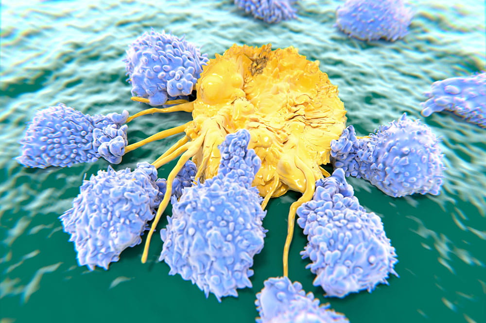 CAR-T cells attach cancer