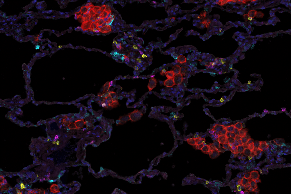 multispectral image of a tumor section
