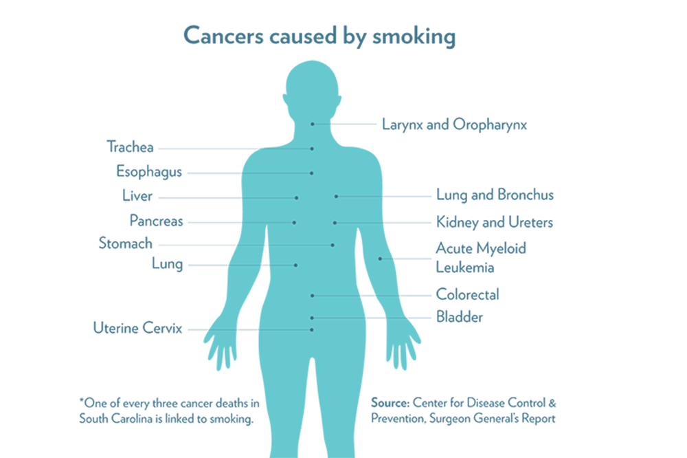 Locations of cancers caused by smoking