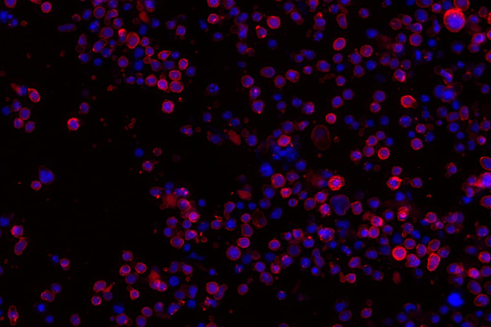 microscopic image of natural killer cells with their nuclei stained blue and CD38 stained pink.